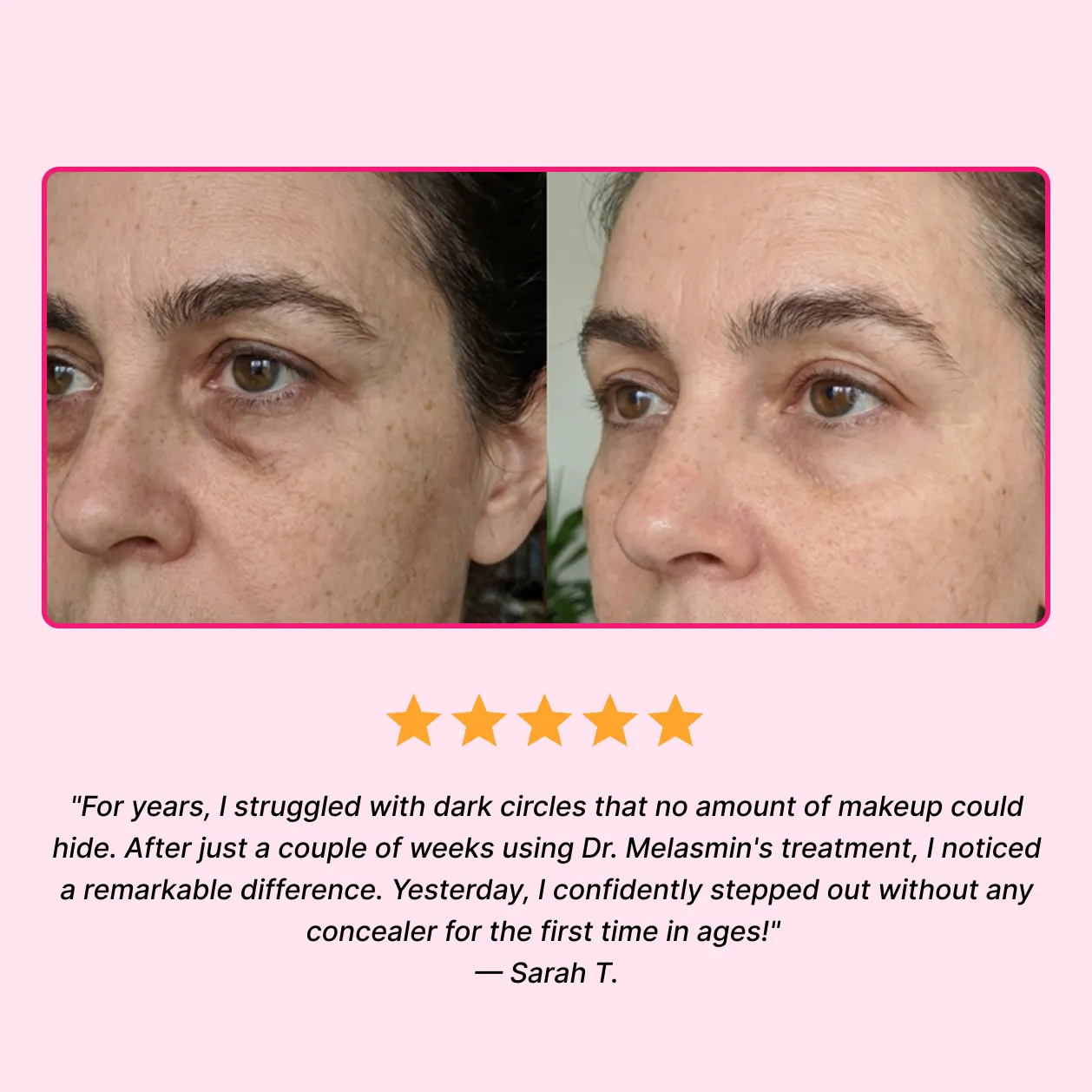 Before and after results